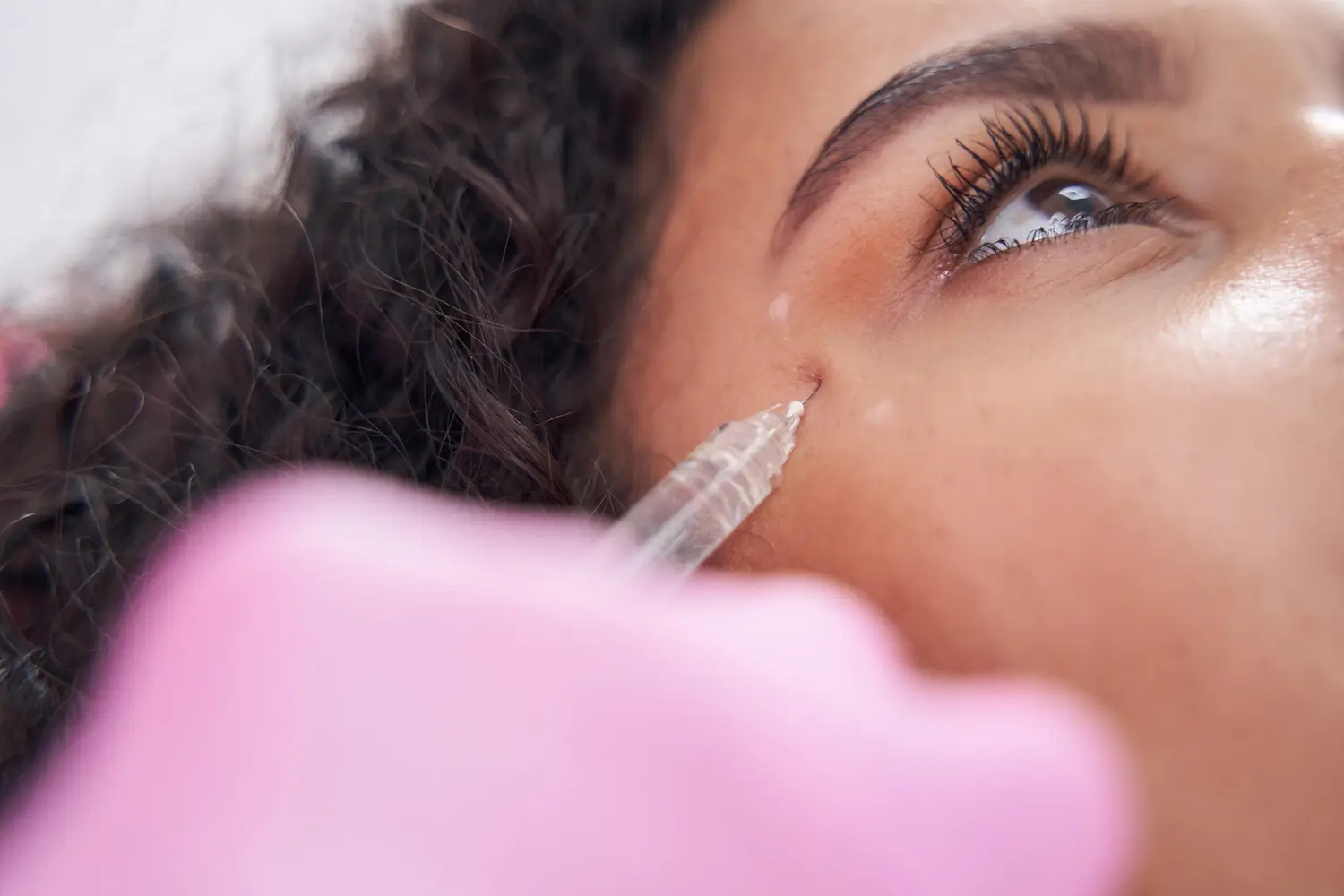 Achieve Youthful Eyes: The Power of PRP Treatment for Under-Eye Bags